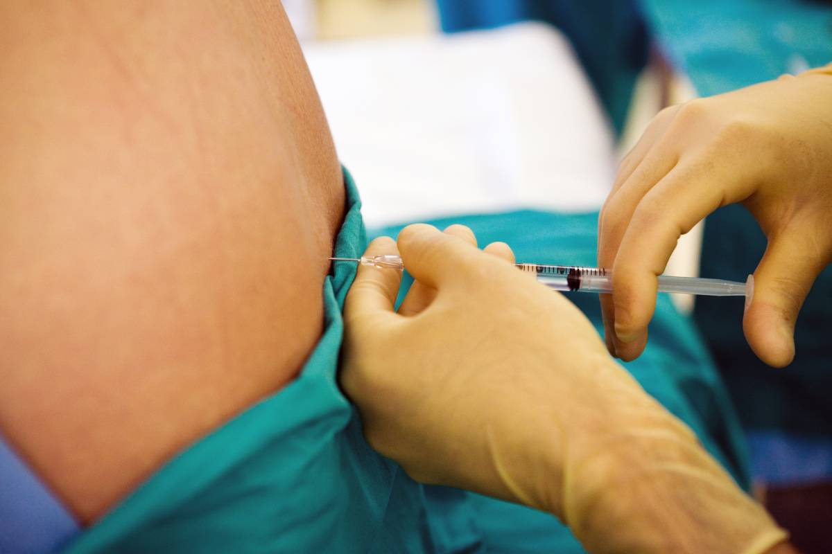 Anesthesia for Lumbar Surgery