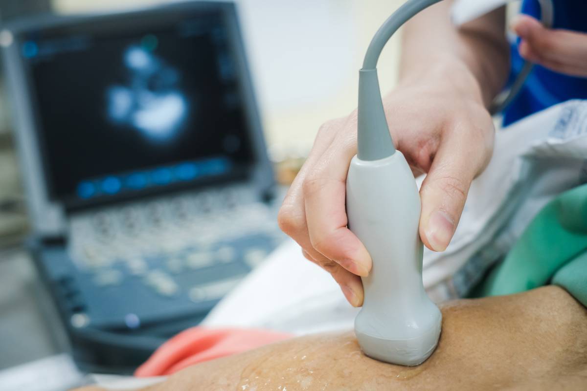 Ejection Fraction: Overview and Considerations for Anesthesia