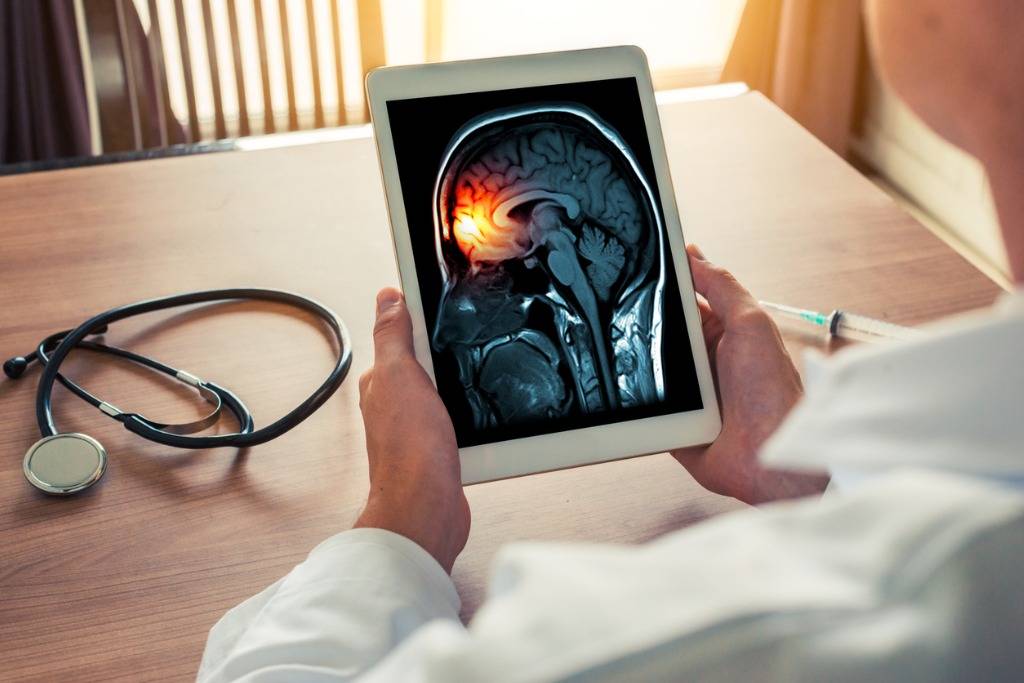 Meningitis: An Overview