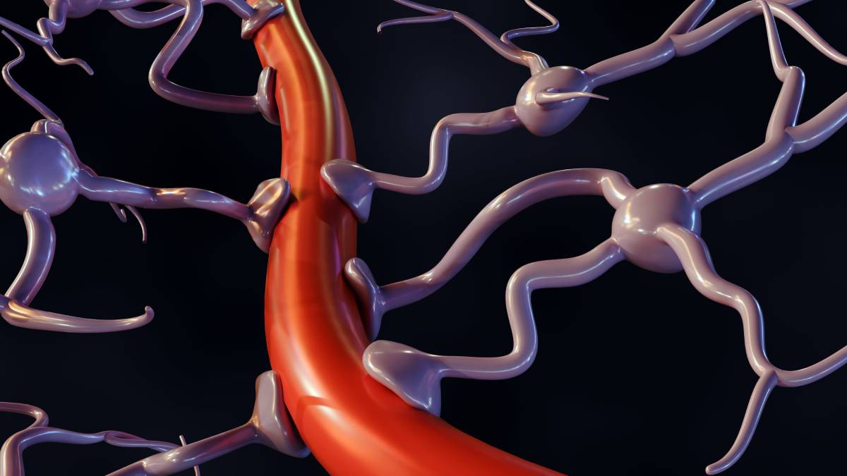 Anesthetics on Neurovascular Coupling